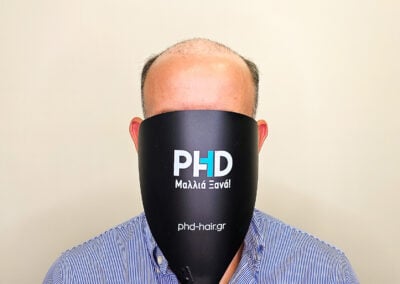 A Man With A Black Object Over His Face