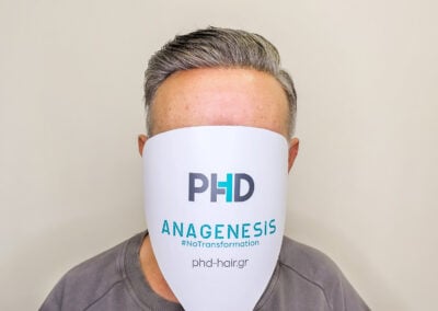 A Man With A White Paper Over His Face Wearing Hair System