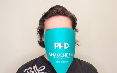 Χρύσανθος με σύστημα μαλλιών PREMIUM Idol