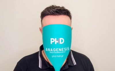 Γεράσιμος με σύστημα μαλλιών ELITE Oscar 003